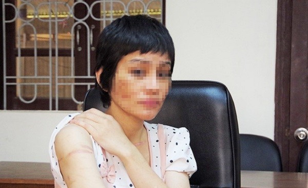 Người chồng khai bạo hành vợ bầu 7 tháng vì ghen-2