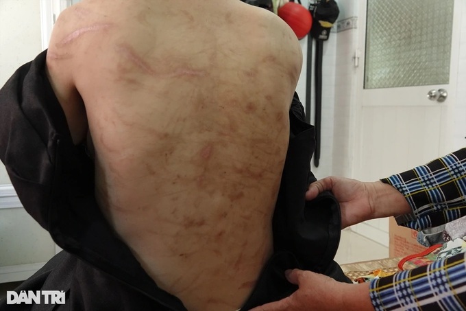 Thai phụ bị bạo hành muốn đón con trai về Kiên Giang-3