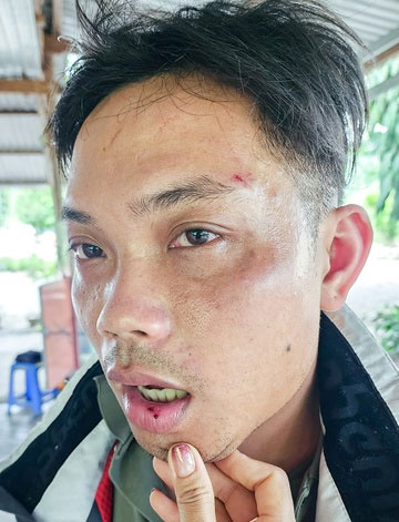 Xác minh thông tin du khách bị đánh ở Nha Trang-1