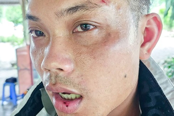 Xác minh hình ảnh hai du khách ôm nhau nhảy nhào lộn ở thác nước Hà Giang-5