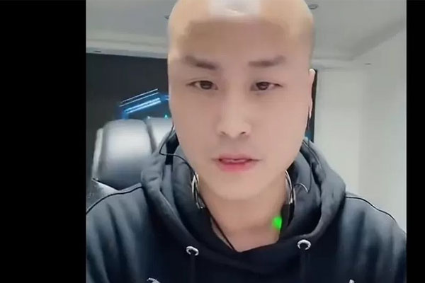 Bị chặt đứt tay khi đang livestream ở Trung Quốc-2