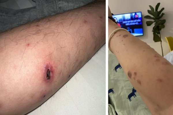 Chàng trai 24 tuổi nhiễm HIV quyết tâm làm lại cuộc sống trong hối hận mỗi ngày-2