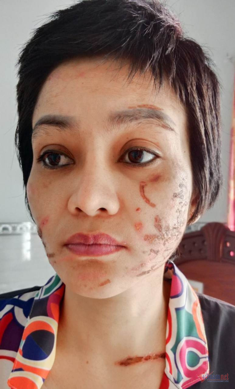 Công an tìm thấy 205 vết thương trên thân thể người vợ mang bầu 7 tháng-4