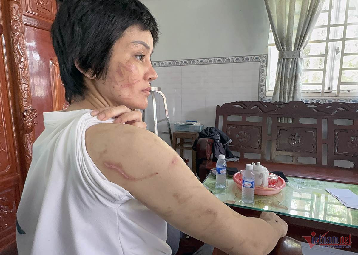 Công an tìm thấy 205 vết thương trên thân thể người vợ mang bầu 7 tháng-3