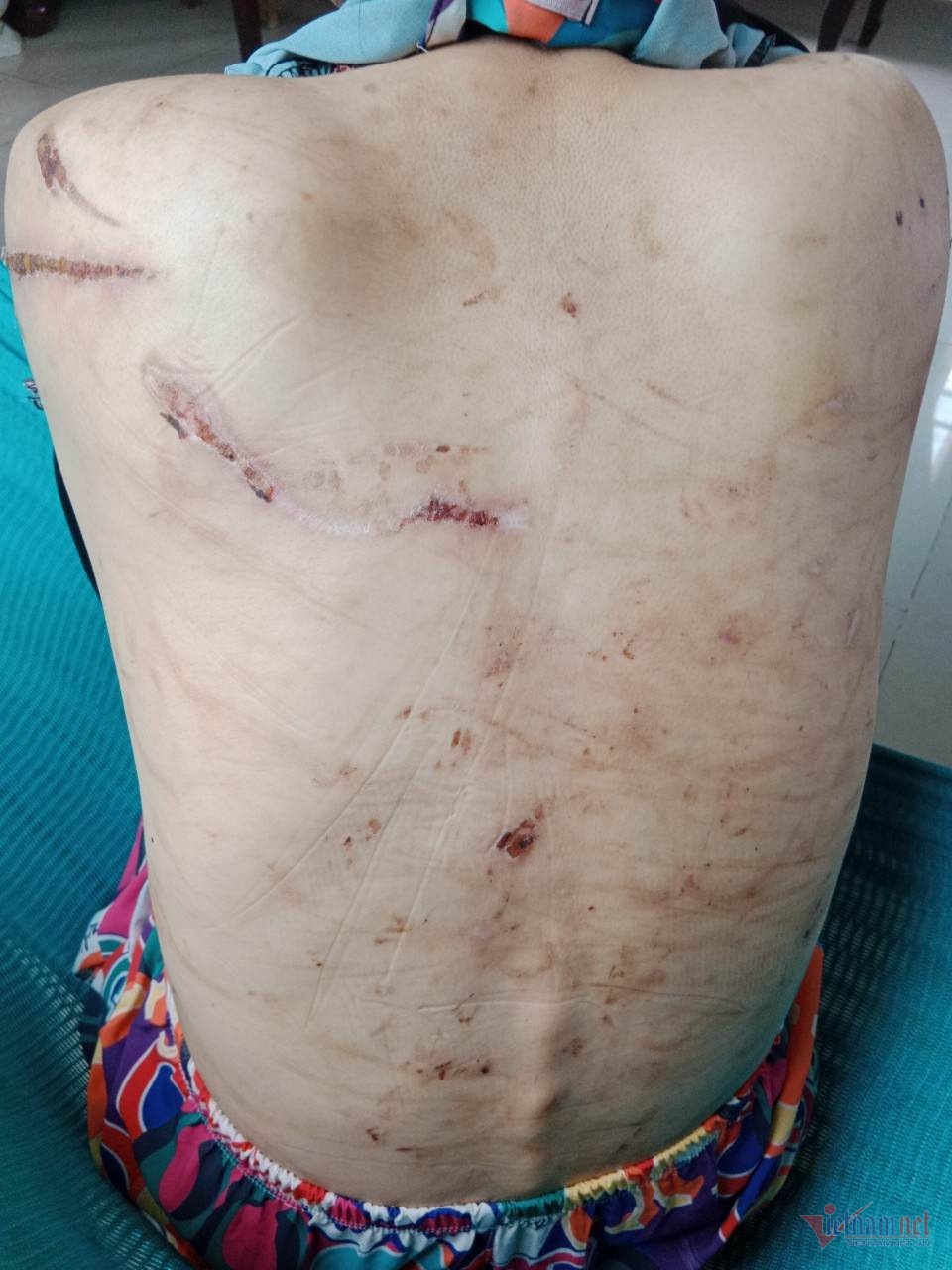 Công an tìm thấy 205 vết thương trên thân thể người vợ mang bầu 7 tháng-2