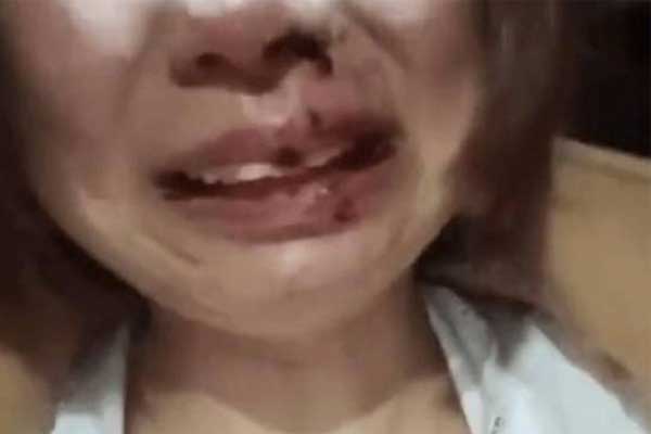 Đăng ảnh ly hôn lên mạng, cô gái bị nhà chồng cũ đánh đập dã man-1