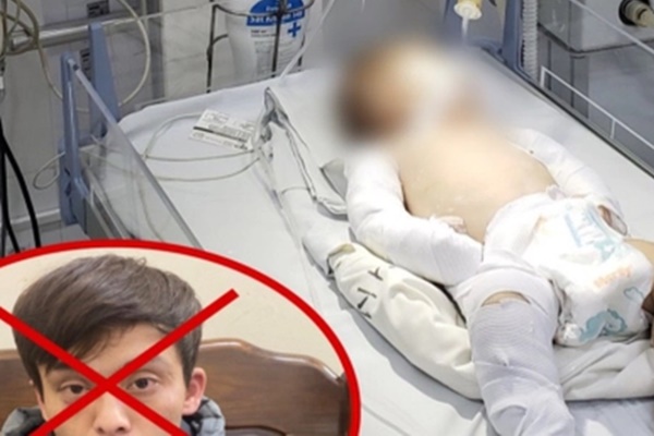 Vụ bé gái sơ sinh bị bạo hành nguy kịch: Khởi tố cha dượng tội giết người-3