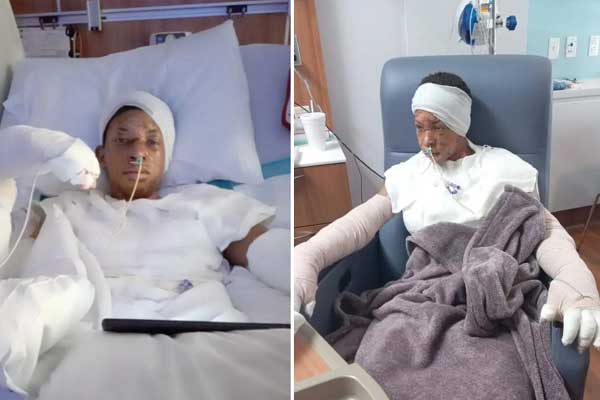 Nam sinh Mỹ bốc cháy như ngọn đuốc vì bắt chước trào lưu mạng-1