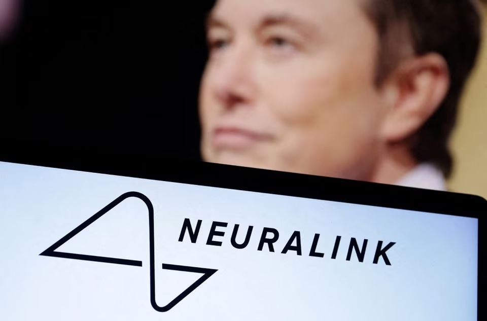 Chip cấy não của Elon Musk sắp được thử nghiệm trên người-1