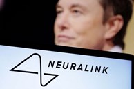 Chip cấy não của Elon Musk sắp được thử nghiệm trên người