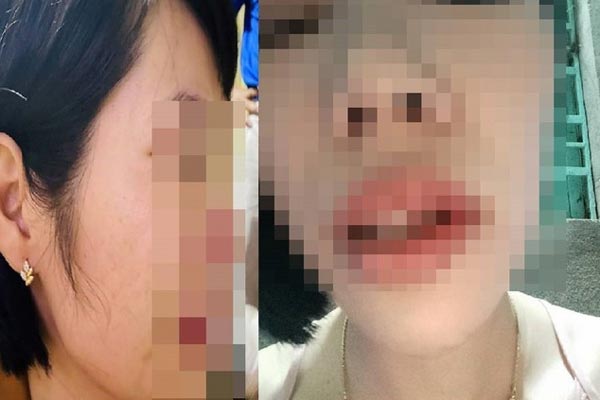 Hiệu trưởng đánh hiệu phó phải nhập viện: Kỷ luật cả hai thầy-2