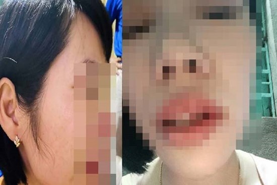 Chỉ đạo khẩn vụ phụ huynh xông vào nhà đánh cô giáo vì con bị hạnh kiểm trung bình