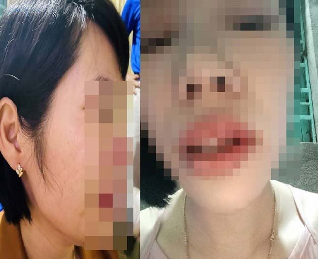 Chỉ đạo khẩn vụ phụ huynh xông vào nhà đánh cô giáo vì con bị hạnh kiểm trung bình-1