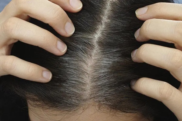 Thuốc nhuộm tóc có gây ung thư không? Nghiên cứu 35 năm khiến nhiều người sững sờ-2
