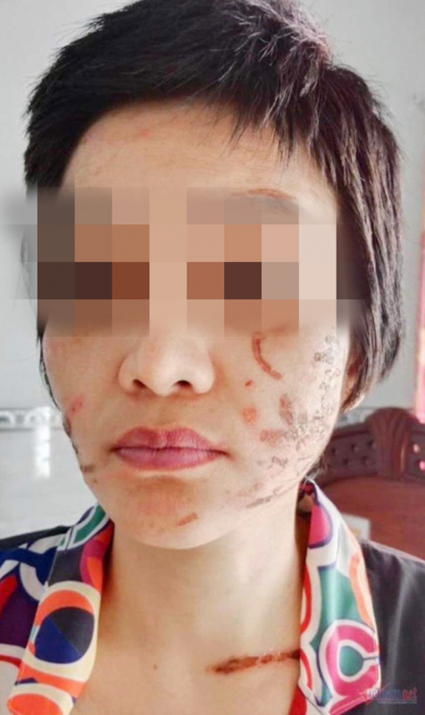 Đêm trường của người vợ bầu bị bạo hành-2