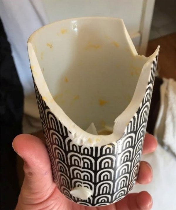 Nấu theo mẹo trên TikTok, người phụ nữ Anh bị bỏng nửa mặt-2