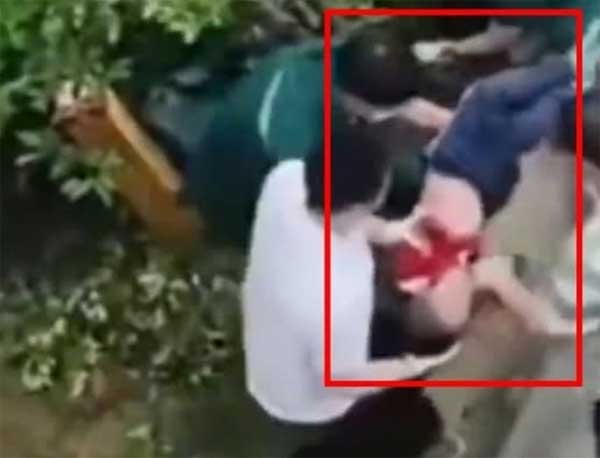 Học theo phim hoạt hình, bé gái thoát chết diệu kỳ khi nhảy từ tầng 26-2