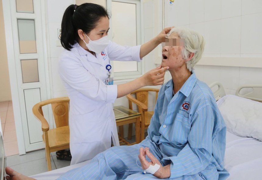 Triệu chứng sưng má cảnh báo căn bệnh nguy hiểm-2