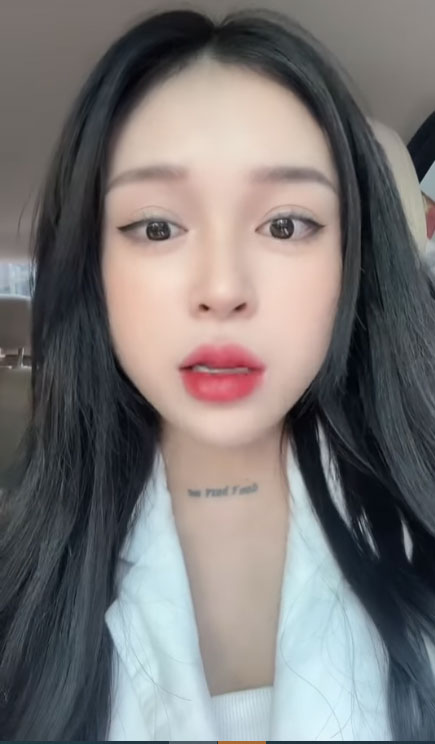 Cô gái Hà Nội liệt nửa mặt vì tắm đêm: Bác sĩ chuyên khoa thần kinh giải đáp về bệnh và cách phòng tránh-1