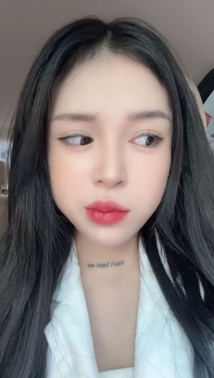 Cô gái Hà Nội liệt nửa mặt vì tắm đêm: Bác sĩ chuyên khoa thần kinh giải đáp về bệnh và cách phòng tránh-2