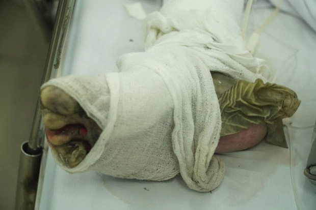 Ghen tuông, đốt phòng trọ ở Đồng Nai: 2 ca tử vong, 1 ca khó qua khỏi-2