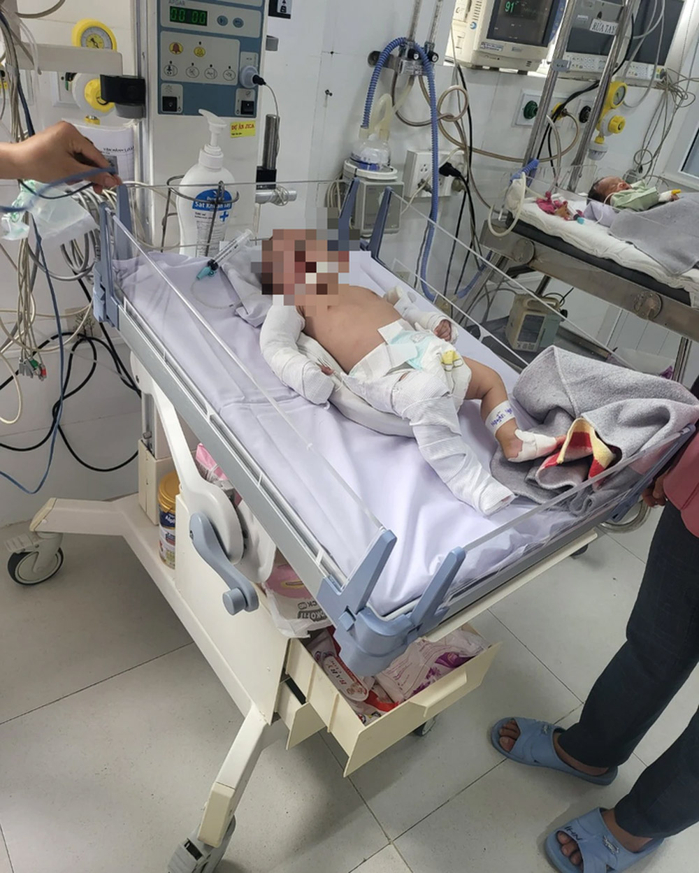 5 lần bị bạo hành dã man khiến bé gái 2 tháng tuổi chấn thương sọ não, gãy đa xương-2