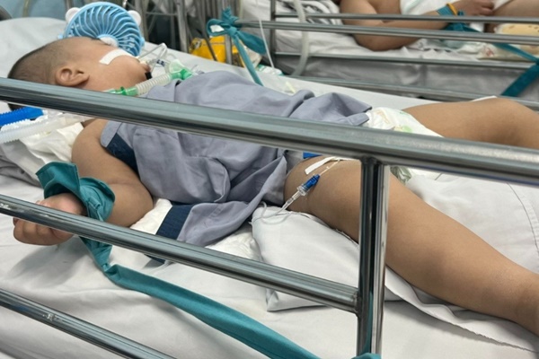 Trẻ 17 tháng tuổi phải lọc máu khi mắc tay chân miệng-2