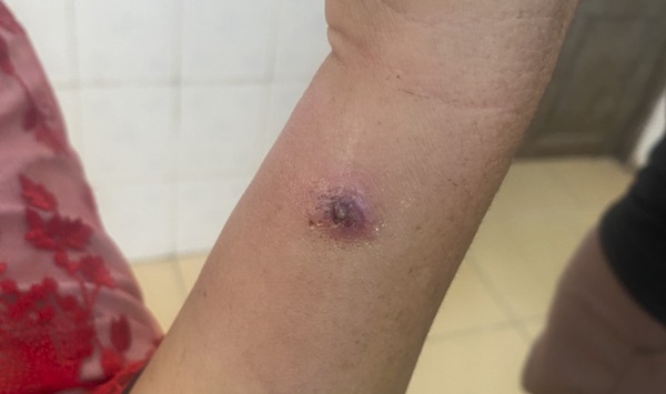 Vi khuẩn bệnh than có thể tồn tại ngoài môi trường từ 30-40 năm-2