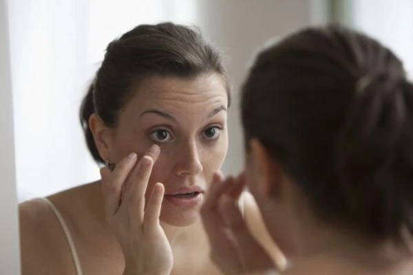 Hai dấu hiệu xuất hiện trên gương mặt chứng tỏ lượng cholesterol đang ở mức cao-2