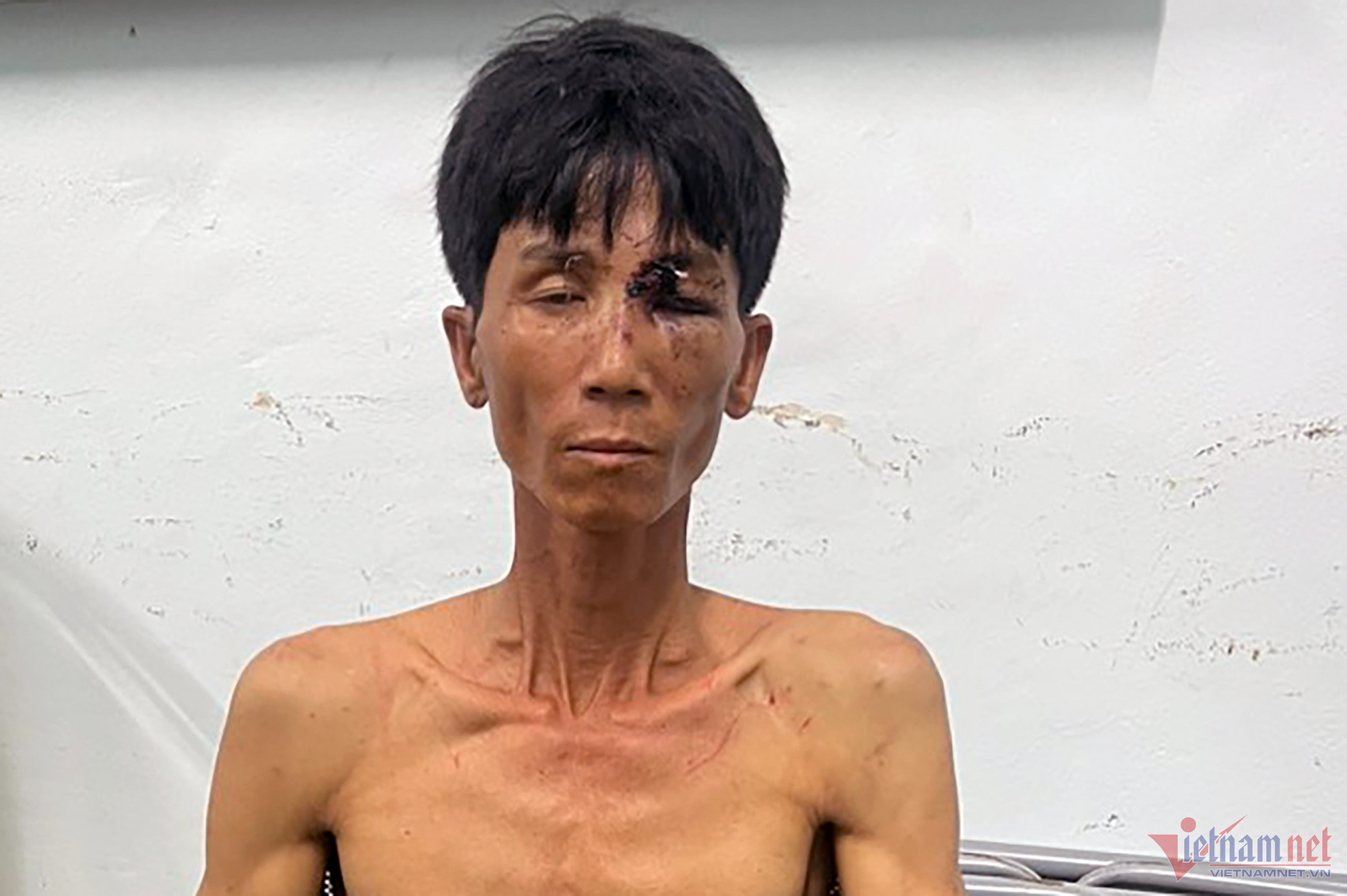 5 ngày trốn chạy trong đói khát của nghi can gây thảm án ở Khánh Hòa-2