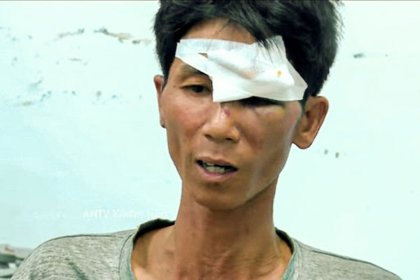 Nồi cơm ăn dở giữa rừng, lộ dấu vết nghi phạm đoạt mạng 3 phụ nữ ở Khánh Hòa-7