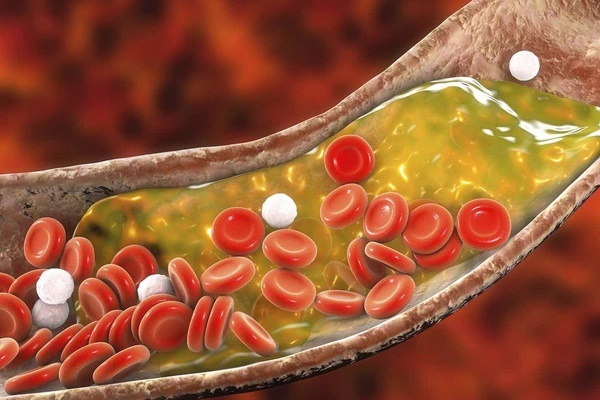 Cơ thể người có sẵn một loại enzym giúp ăn mãi không béo, cách kích hoạt nó thế nào?-2