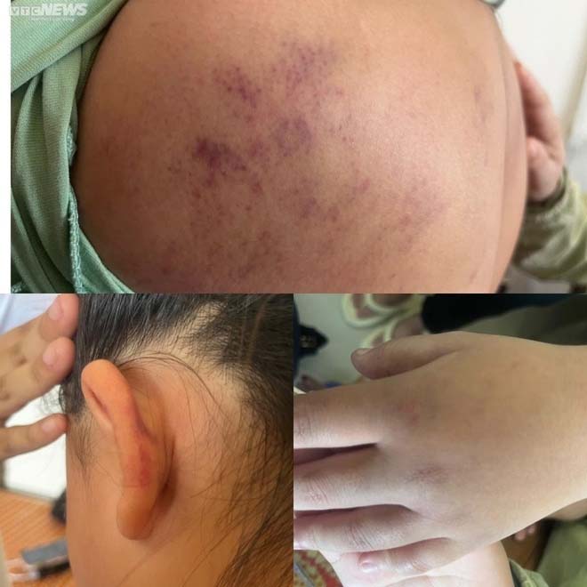 Nhóm thiếu nữ thừa nhận lột đồ, đánh hội đồng bạn suốt 2 giờ-1