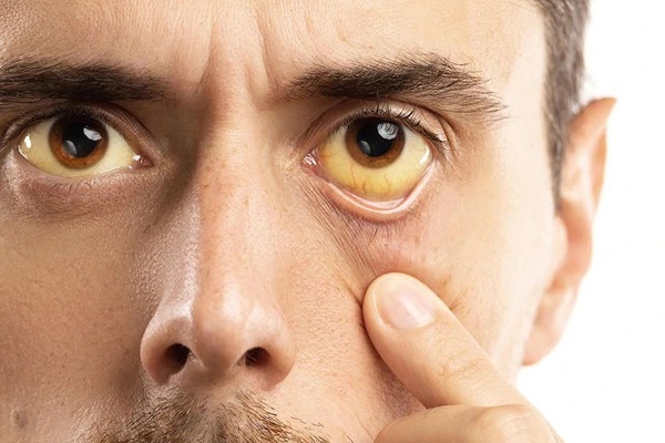 Sáng nào cũng tỉnh giấc vào đúng khung giờ này có thể là dấu hiệu gan đang kêu cứu”-1