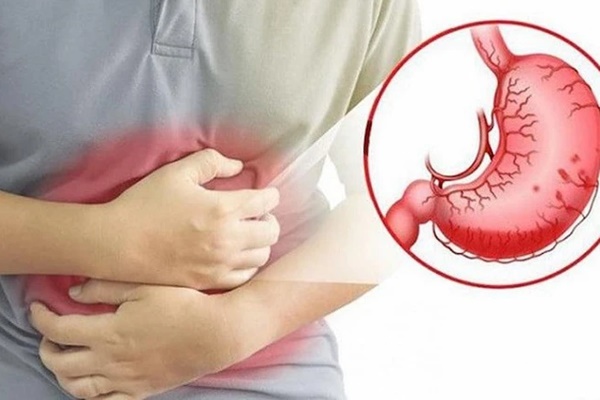 Không hút thuốc, uống rượu, nữ MC vẫn phát hiện polyp và bị hạ gục bởi 3 vết thủng dạ dày, tự vạch trần một thói quen nhiều người mắc-4