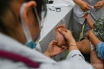 Hơn 10 trẻ nguy kịch trong tuần, Bộ Y tế vào TP.HCM giám sát bệnh tay chân miệng-2