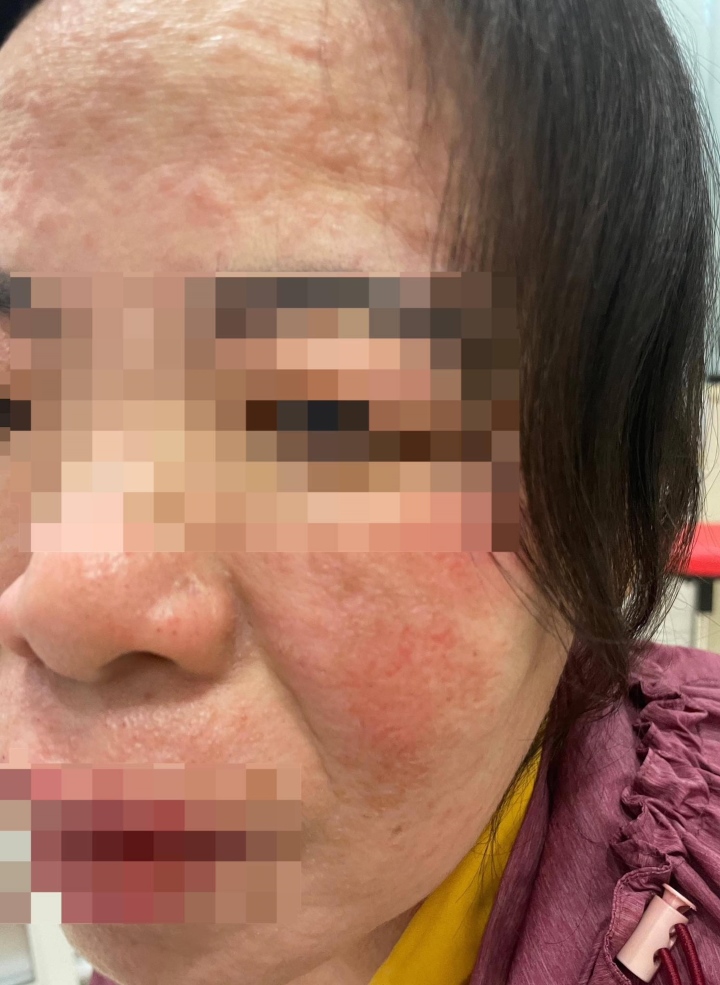 Tin lời nhân viên spa dùng viên chống nắng, phơi mặt da vẫn đẹp và cái kết-1