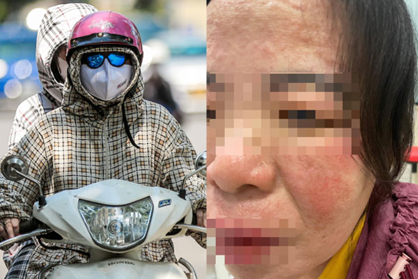 Thành phần tẩy da chết dành cho làn da bị nám-3