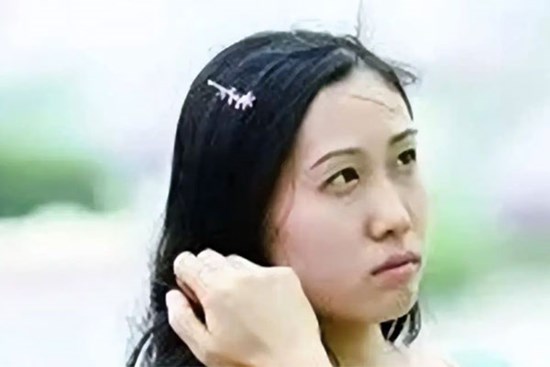 Từng là thần đồng được ca tụng, cuộc đời cô gái lao dốc vì cách giáo dục cực đoan của bố