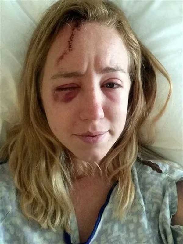 Người phụ nữ bất ngờ có thêm giác quan mới sau khi bị sét đánh-2