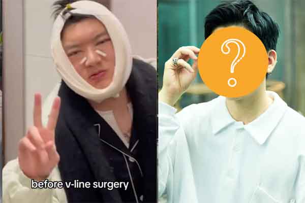 Bạn gái B Ray bị khui” loạt ảnh thời chưa phẫu thuật thẩm mỹ, khác cỡ nào mà chính chủ phải lên tiếng?-6