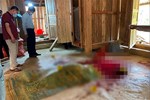 Người phụ nữ ở Hà Tĩnh bị chồng dùng dao nhọn phóng xuyên lưng-3