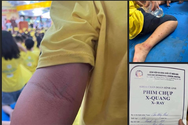 Vụ câu được thủy quái trắm đen 40kg: Quyết định bất ngờ của cần thủ-3