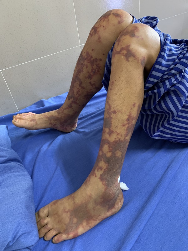 Suýt chết vì món ăn bán khắp nơi ở Việt Nam-1