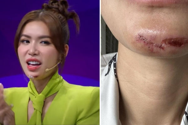 Minh Tú chính thức ngỏ lời cầu hôn bạn trai ngoại quốc, showbiz Việt sắp có thêm đám cưới-5