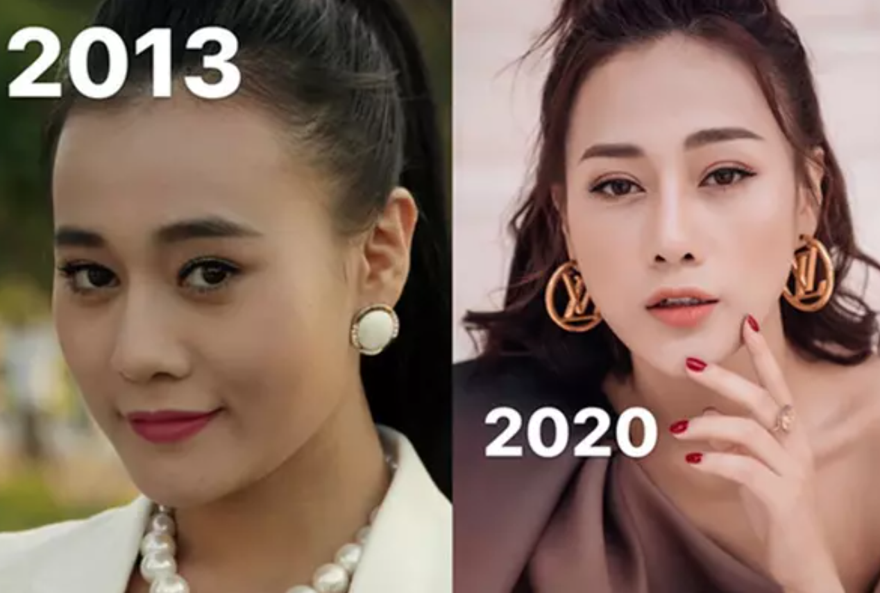 Rần rần hình ảnh Phương Oanh trước khi phẫu thuật thẩm mỹ, so với hiện tại nhan sắc ra sao?-4
