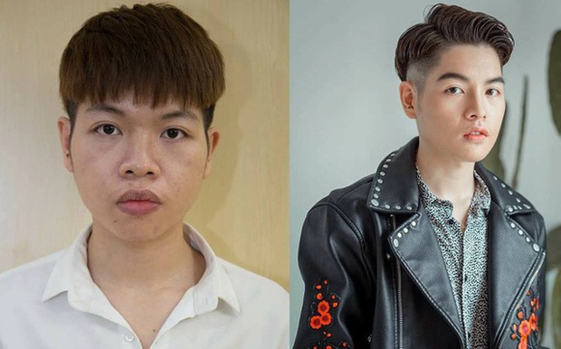 Sao nam từng bị ám ảnh ngoại hình nhưng sự nghiệp quay ngoắt 180 độ nhờ phẫu thuật thẩm mỹ-3