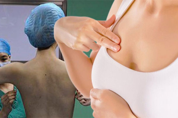 Chi tiền triệt lông vĩnh viễn để vĩnh viễn đi triệt lông-6