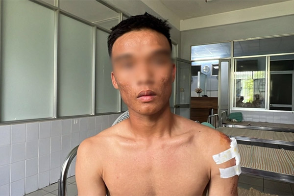 Tin mới nhất vụ xe chở CLB bóng đá trẻ Quảng Nam bị lật-3