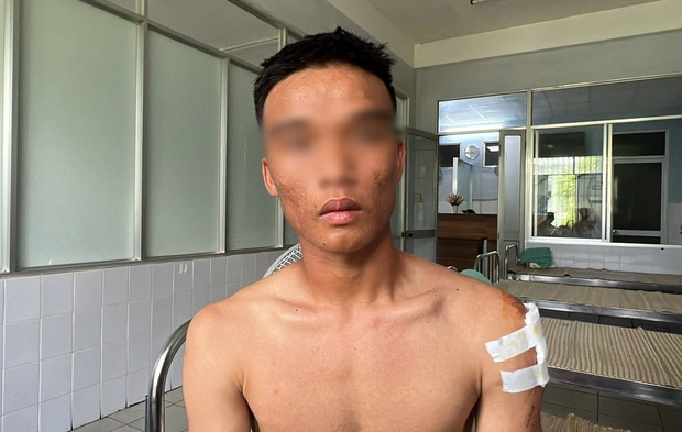 Cầu thủ Quảng Nam hoảng hồn kể lúc xe chở đội bóng mất lái, bị lật trên đèo khiến 4 người thương vong-3